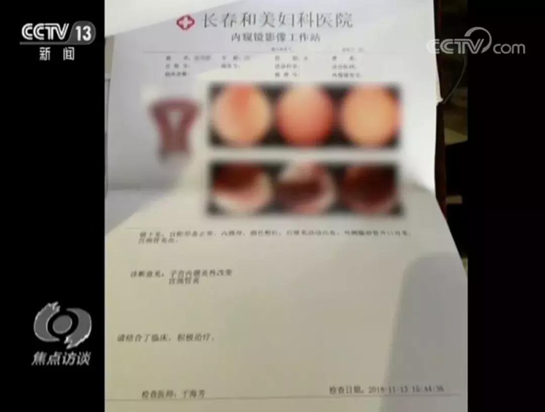 宫腔镜之旅，探寻价格背后的故事与自我成长之路
